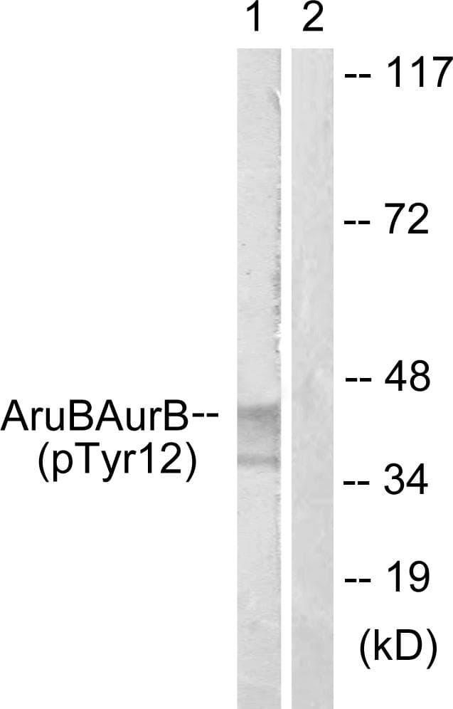 Polyclonal Rabbit anti-Human AURKB / Aurora-B Antibody (phospho-Tyr12, IHC, WB)