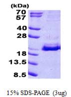 Human SRP19 Protein (Recombinant His)