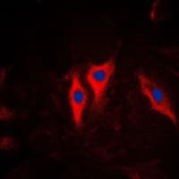 PathPlus™ KRT5 / CK5 / Cytokeratin 5 Antibody (C-Terminus)
