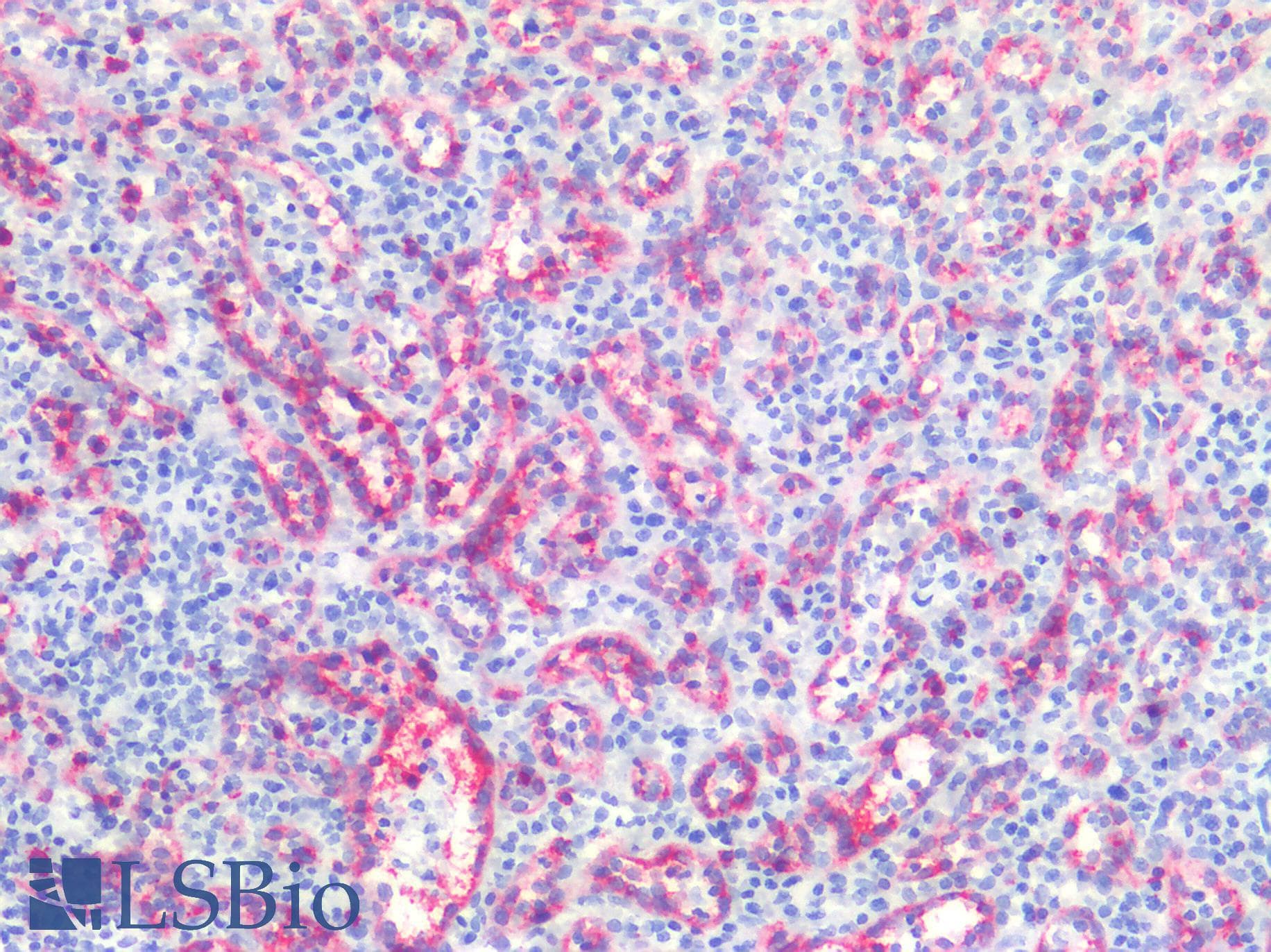 PathPlus™ Polyclonal Rabbit anti-Human CD8A / CD8 Alpha Antibody (clone P17-V, C-Terminus, IHC)