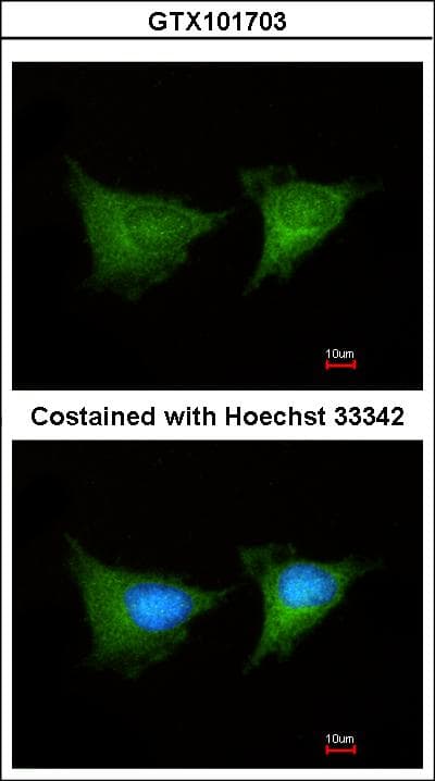 PGD Antibody (aa1-201)