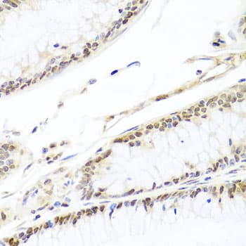 Polyclonal Rabbit anti-Human HIRA Antibody (IHC, WB)