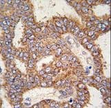 TRPM8 Antibody (aa1075-1104)