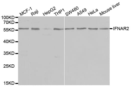 IHC-plus™ IFNAR2 Antibody