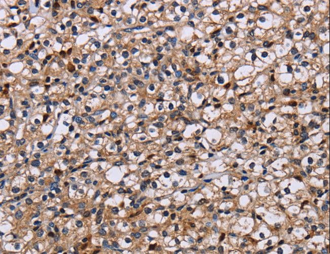 NCSTN / Nicastrin Antibody