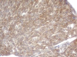 SCFD1 / SLY1 Antibody (clone OTI2B7)