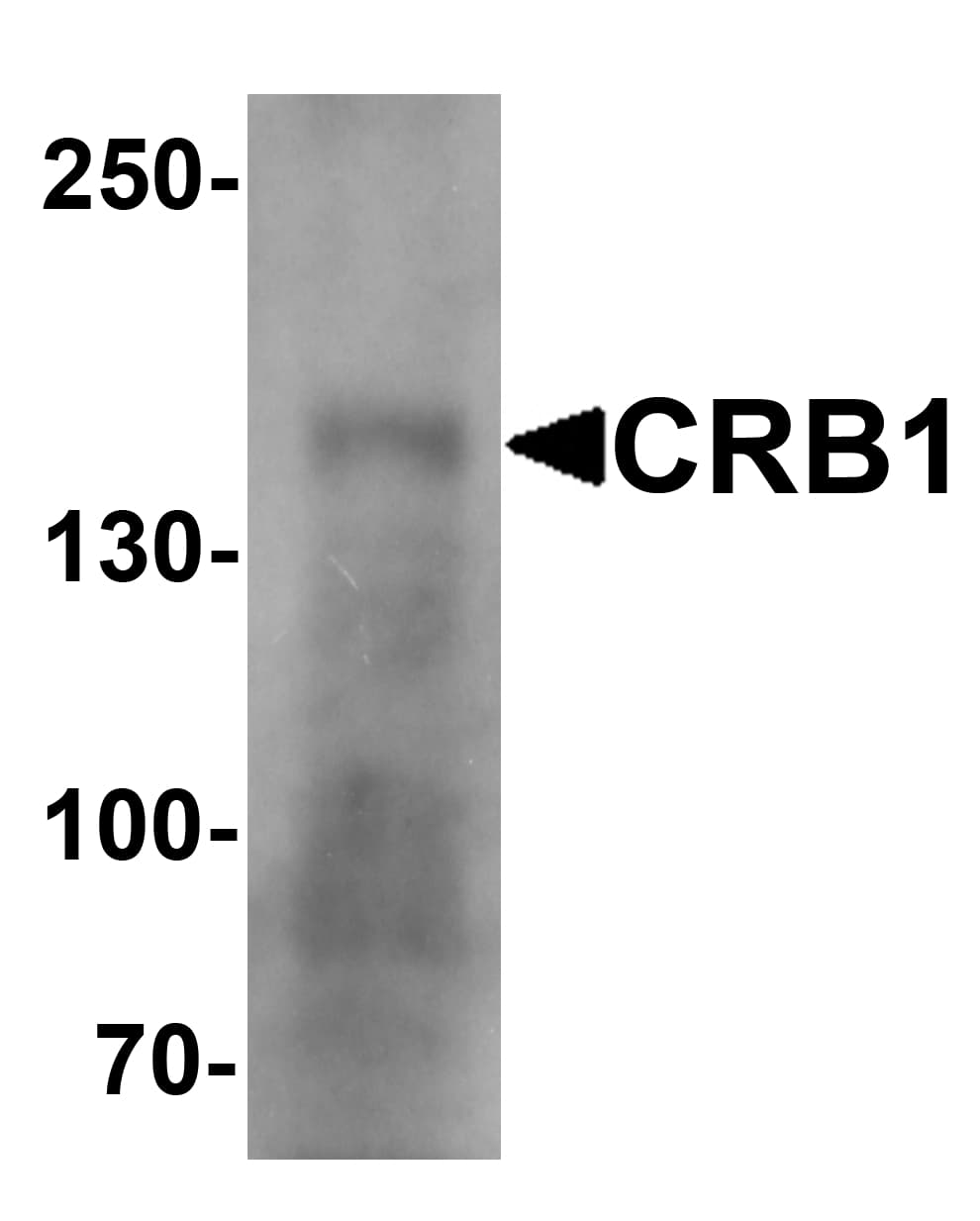 IHC-plus™ CRB1 Antibody