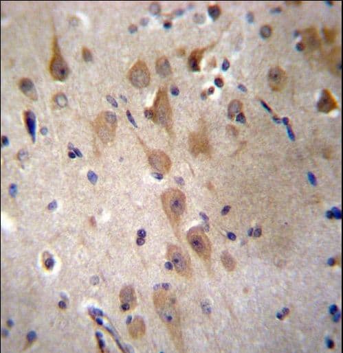 Polyclonal Rabbit anti-Human GRIP2 Antibody (aa620-649, IHC, WB)