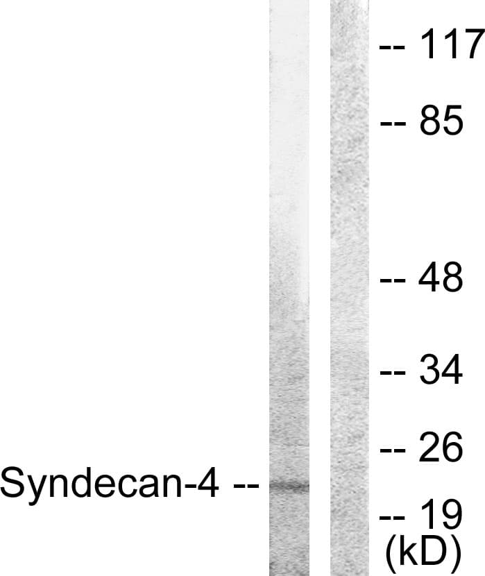 SDC4 / Syndecan 4 Antibody (aa145-194)