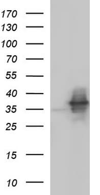 Monoclonal Mouse anti-Human NFKBIA / IKB Alpha / IKBA Antibody (clone OTI1D4, IF, WB)