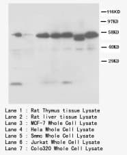 CASP8 / Caspase 8 Antibody (Internal)