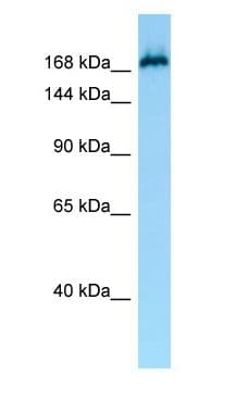 Polyclonal Rabbit anti-Human MAST1 Antibody (aa331-380, WB)