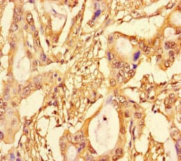 SPT3 / SUPT3H Antibody