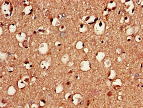 RNF40 / STARING Antibody