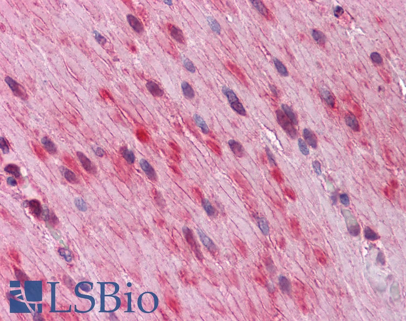 IHC-plus™ Monoclonal Mouse anti-Human GATA3 Antibody (clone 7B5, IHC, WB)