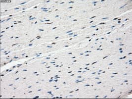 FRA-1 / FOSL1 Antibody (clone OTI12F9)