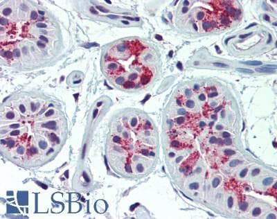 IHC-plus™ SLC5A5 / NIS Antibody
