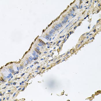 IHC-plus™ Polyclonal Rabbit anti-Human DSG1 / Desmoglein 1 Antibody (IHC, WB)