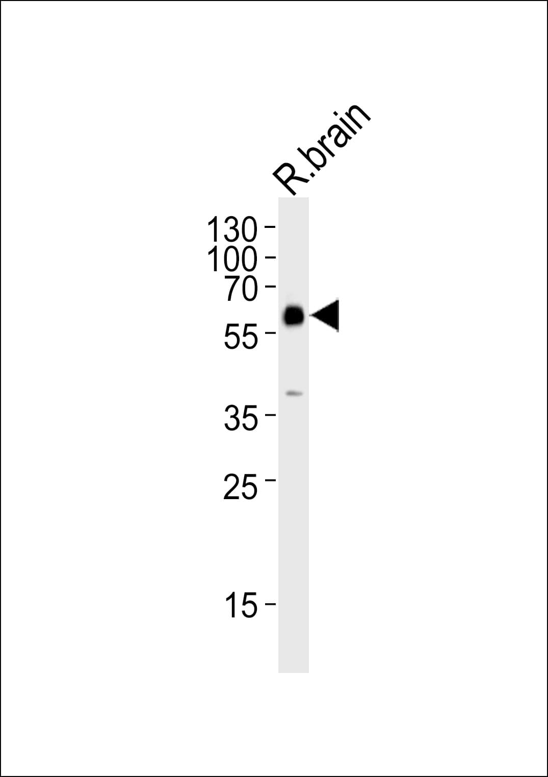 GAD65 Antibody (aa109-138)