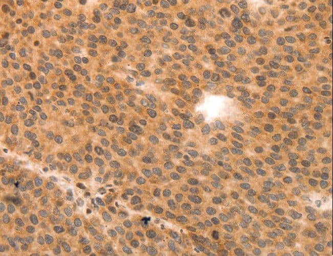 MLC2 / MYL9 Antibody