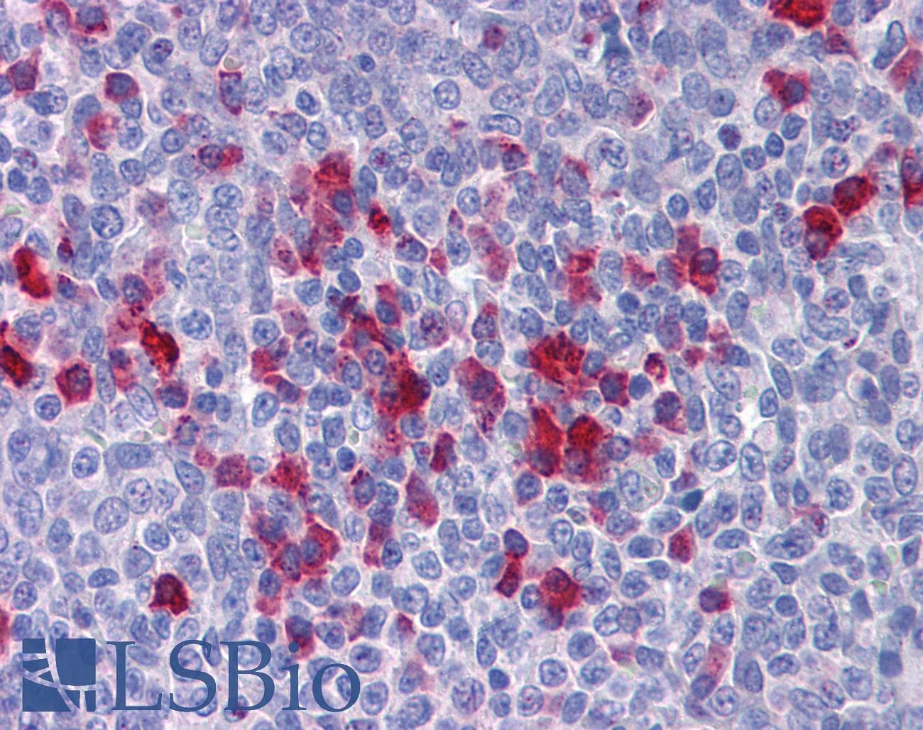 APPL1 / APPL Antibody (aa467-516)
