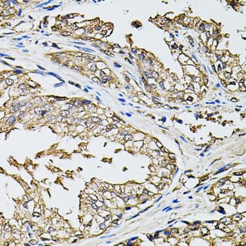 RASSF5 / RAPL Antibody