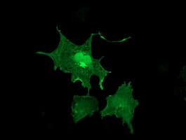 LIMK1 / LIMK Antibody (clone OTI3H6)