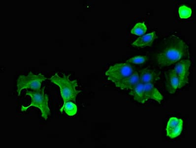Polyclonal Rabbit anti-Human OSMR / IL-31R-Beta Antibody (IHC, IF)