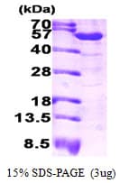 Human ALDH1A1 / ALDH1 Protein (Recombinant)
