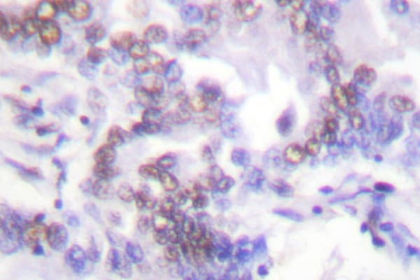 SENP6 Antibody (Lys1077)