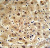 HPX / Hemopexin Antibody (aa200-227)