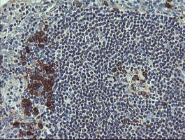UBE2J1 Antibody (clone OTI3E6)