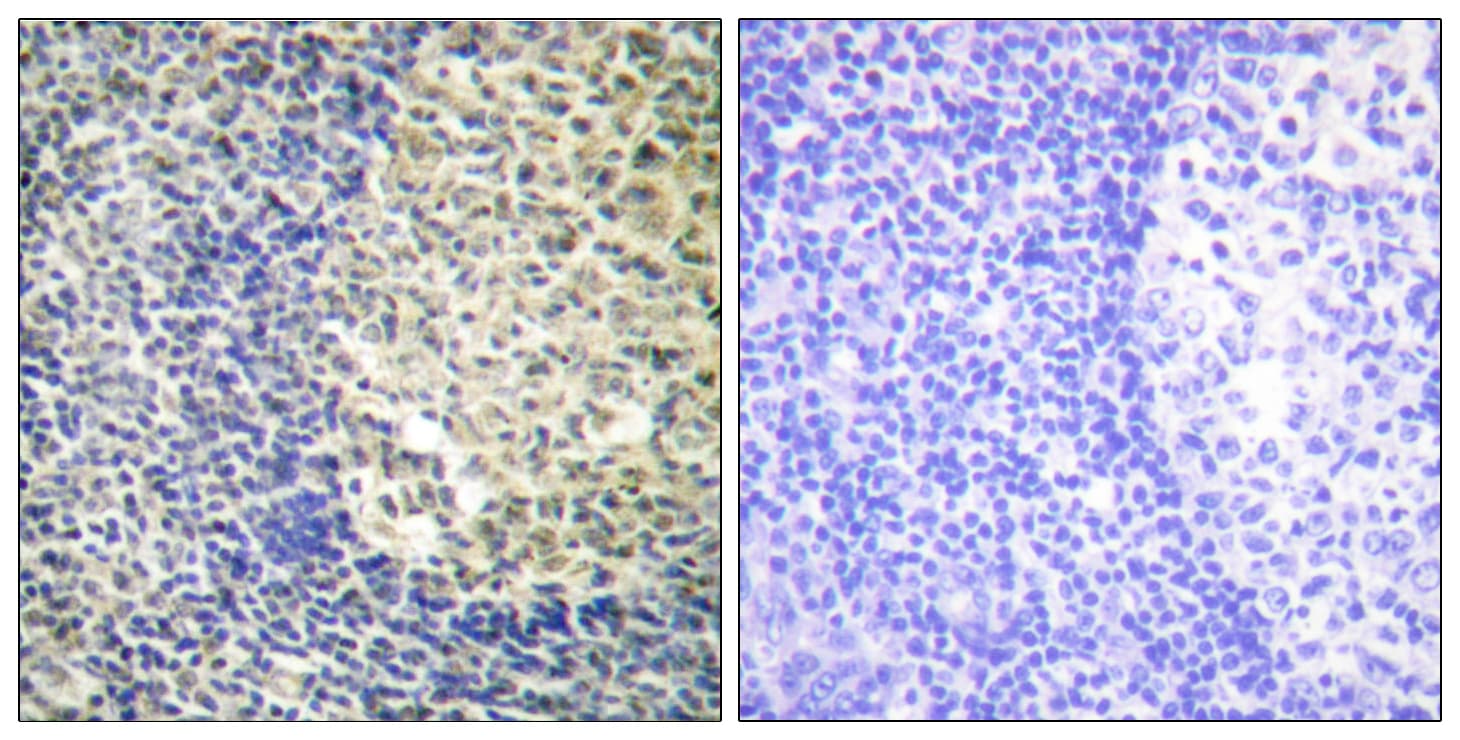 NCF1 / p47phox / p47 phox Antibody (phospho-Ser370)