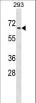 PTPN5 / STEP Antibody (aa1-30)