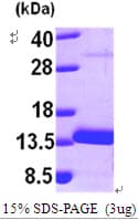 Human MTPN / Myotrophin Protein (Recombinant His)