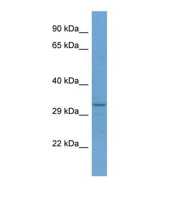 Polyclonal Rabbit anti-Human RNF150 Antibody (aa184-233, WB)