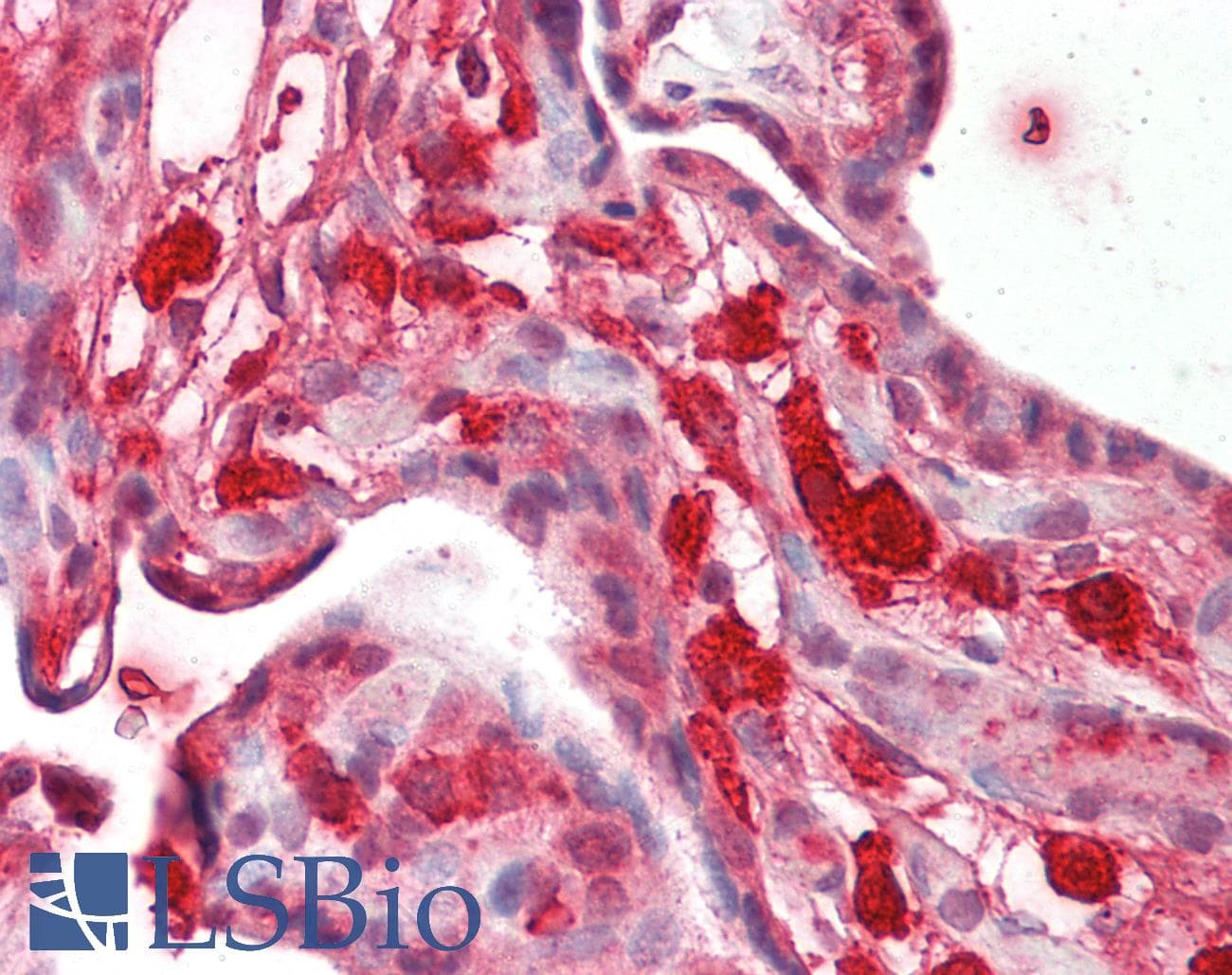 Polyclonal Rabbit anti-Human Fibulin-3 / EFEMP1 Antibody (aa396-445, IHC, WB)