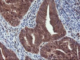 HDHD1 Antibody (clone OTI7A2)