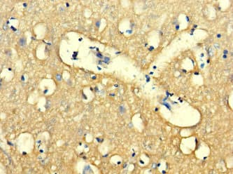 Polyclonal Rabbit anti-Human WDR27 Antibody