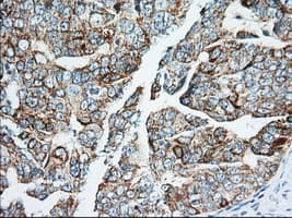 IGF2BP2 Antibody (clone OTI3F9)