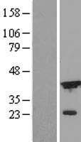DFFA / ICAD / DFF45 Protein (Over-Expression Lysate Myc-DDK (Flag))