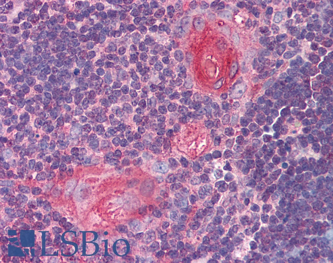 IHC-plus™ Polyclonal Rabbit anti-Human SMC4 Antibody (aa281-297, IHC, WB)