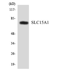SLC15A1 / PEPT1 Antibody (aa210-259)