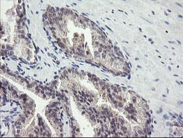 FBXO42 / JFK Antibody (clone OTI1H4)