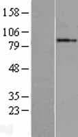 GGCX Protein (Over-Expression Lysate Myc-DDK (Flag))