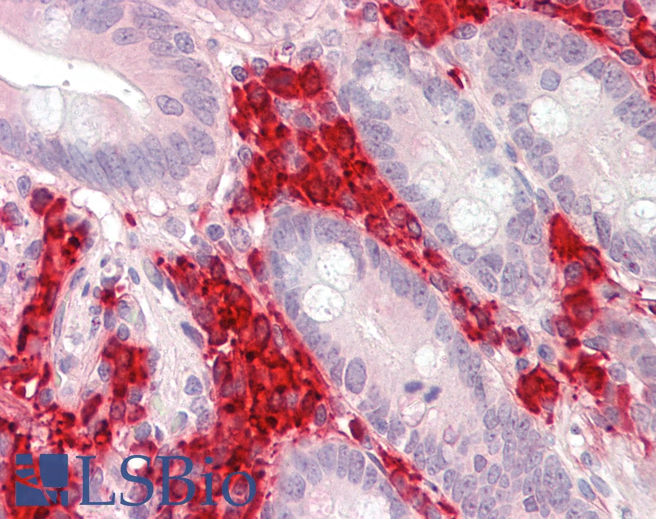 IHC-plus™ TXNDC5 / ERP46 Antibody (aa269-282)