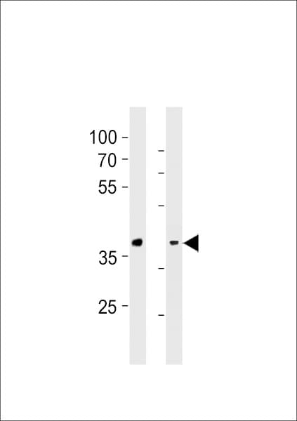 Polyclonal Rabbit anti-Human GPR4 Antibody (aa196-224, WB)