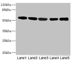 FRK Antibody