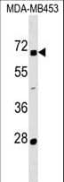 ZNF565 Antibody (aa69-95)