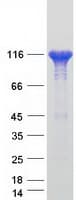 Human VCL / Vinculin Protein (Recombinant Myc-DDK (Flag))